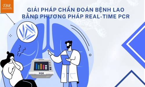 GIẢI PHÁP CHẨN ĐOÁN BỆNH LAO BẰNG PHƯƠNG PHÁP REAL-TIME PCR